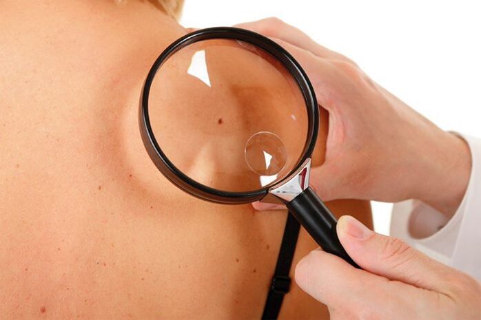 Exame de um paciente com HPV