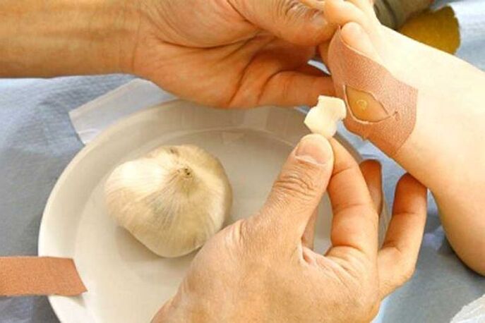 Tratamento de papiloma com compressa de alho