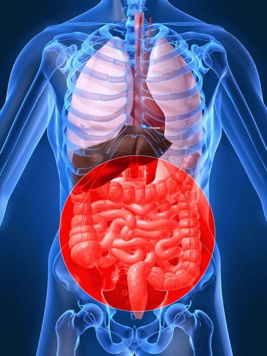 A disbiose intestinal provoca ativação do papilomavírus humano